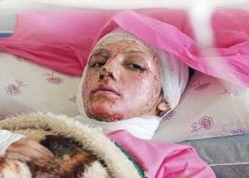 وحشیة قصوی: هجمات برش الحامض علی النساء بذریعة سوء التحجب