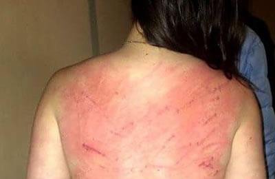 إيران : إدانة 4 نساء بتحمل الجلد والحبس