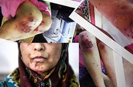 ايران:  255إمرأة شاكية للعنف من قبل أزواجهن