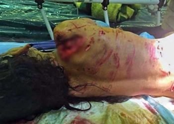 طفلة بائعة الزهور تتعرض للهجوم من قبل 10 كلاب صائبة في ليلة شتاء بارد