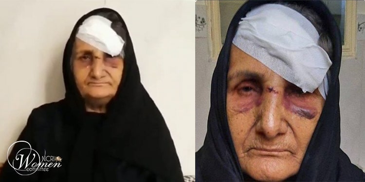 كوهر عشقی –مهاجمون يلقون الأم المسنة كوهر عشقی على الأرض ويصيبونها بجروح