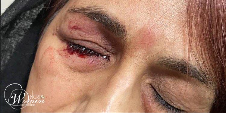 شكوفه كودرزي وهي أُم شجاعة قامت بتحرير ولديها لكن فقدت البصر في إحدى عينيها