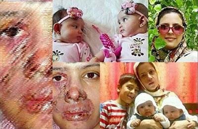 ایران:‌ بیمارستان، محل درمان یا خشونت علیه زنان؟