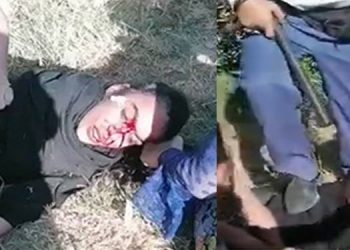 رفتار ضدانساني با يك دختر مجروح در آبادان توسط حراست شركت نفت