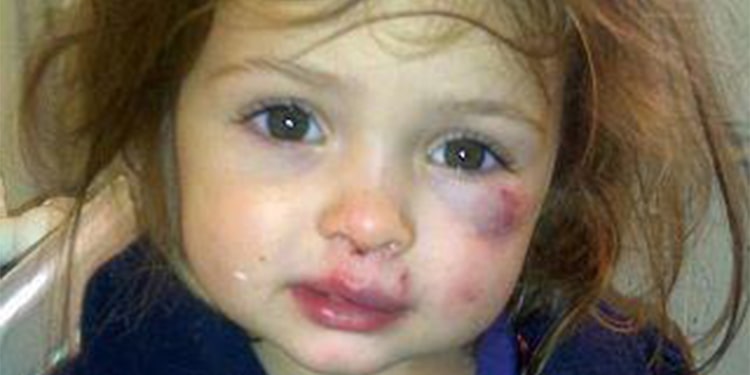 کودک آزاری در ایران در صدر آسیب های اجتماعی