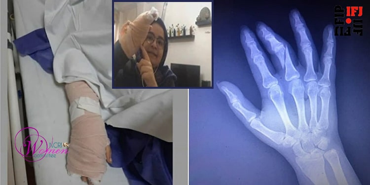 مقاومت این خبرنگار در برابر خواست غیرقانونی مأمور حراست، به ضرب و شتم، شکستگی انگشت و جراحی دست او منجر شد.