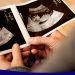 ممنوعیت غربالگری زنان رسماً به مراکز درمانی و خدمات پزشکی ابلاغ شد