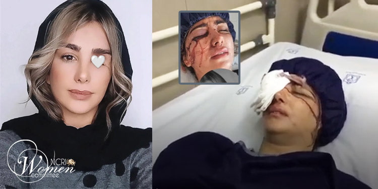 زنان جسور ایران با ساچمه نابینا می شوند