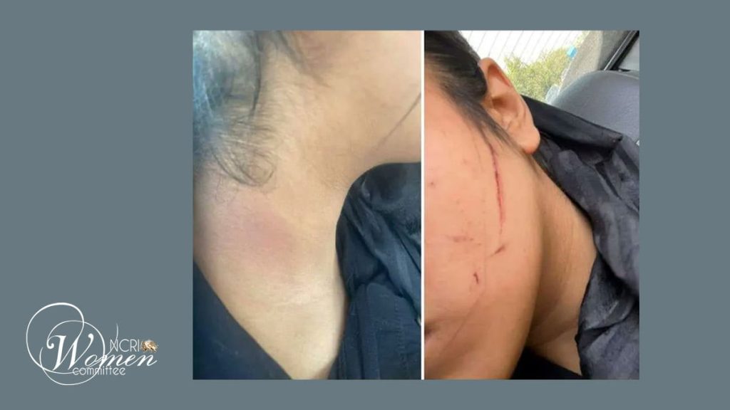 نفس حاجی شریف پس از برخورد وحشیانه گشت ارشاد دچار آسیب روحی شد