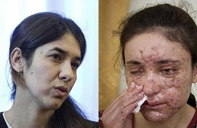 Deux femmes Yazidi remportent le Prix Sakharov du Parlement européen