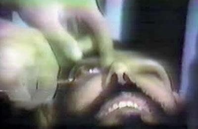 Un prisonnier aveuglé des deux yeux en Iran