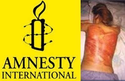 Amnesty International dénonce les châtiments inhumains en Iran  y compris contre des femmes