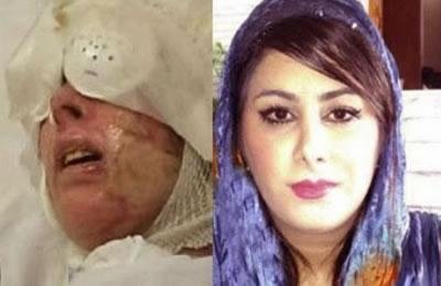 Iran: Une victime d’une agression à l’acide dans un état critique