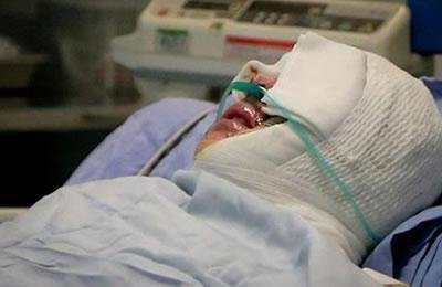 Iran: Une jeune femme agressée par l’acide