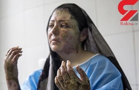 Iran : Une deuxième femme agressée à l’acide à Tabriz