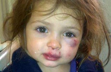 13.000 cas de maltraitance d’enfants