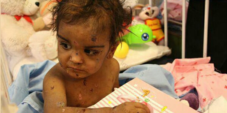 La maltraitance des enfants en Iran pendant la pandémie de coronavirus