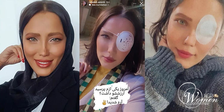 Les femmes iraniennes courageuses perdent leurs yeux, mais leur cœur