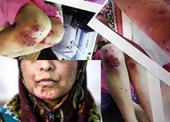 Woman and two daughters tortured 21 days, MP does not care