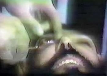 Savage blinding of both eyes of a prisoner