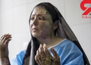 A second woman targeted with acid in Tabriz