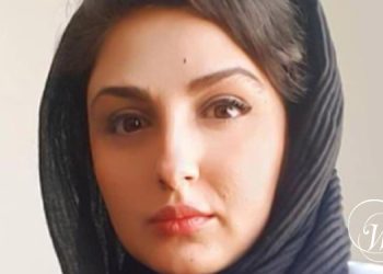 Dr. Ayda Rostami found dead with a smashed face, broken arm, and enucleated eye